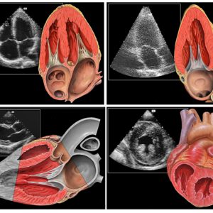 Herzechokardiografie